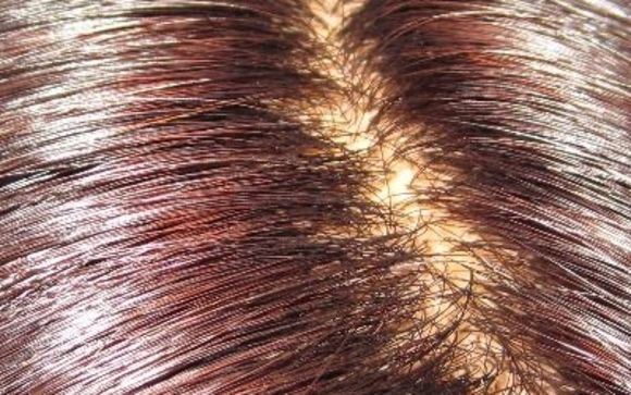 Freedom Hair of New Zealand vacuum-fit prosthesis by Fuller Hair Inc