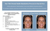 Free Virtual Smile Simulation by Town & Country Dental Care
