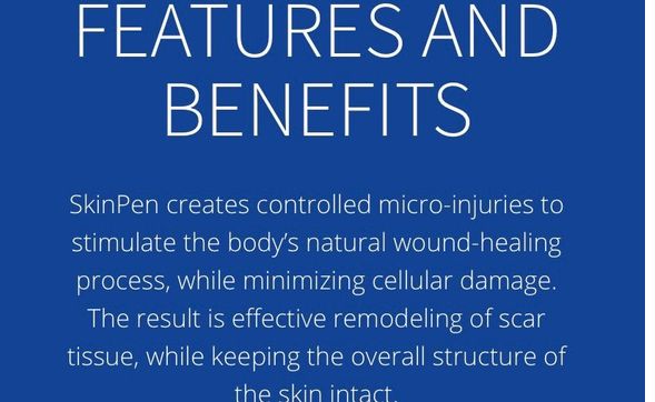 SkinPen Microneedling  by Luna Esthetics & Wellness