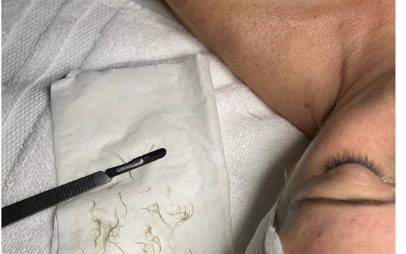 Dermaplaning + Light peel by Layla Skin Care and Waxing