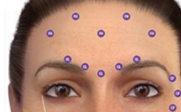 Botox by Skincare by Carrilyn