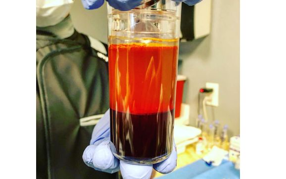 Stem Cell Treatments by Naples Regenerative Institute