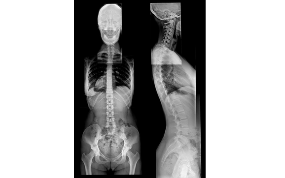 Full Spine X-Ray by Reformation Chiropractic