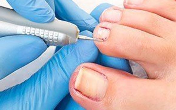 Diabetic Therapeutic Pedicure by Treat Your Feet