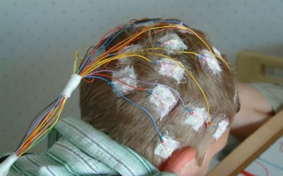 Outpatient EEG Testing by Sutter Medical Center | Ose Adams Medical Pavilion