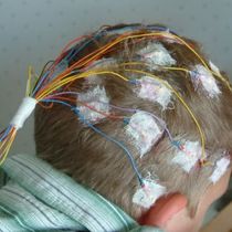 Outpatient EEG Testing by Sutter Medical Center | Ose Adams Medical Pavilion