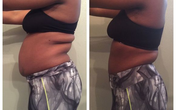 Weight Management by BE Vitalized & Energized Wellness Center