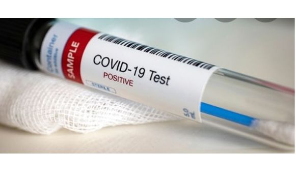 Covid-19  PCR and Antibodies  by Phlebo OnThe Go