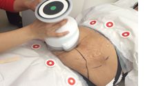Nonsurgical lipo by Healthydermis