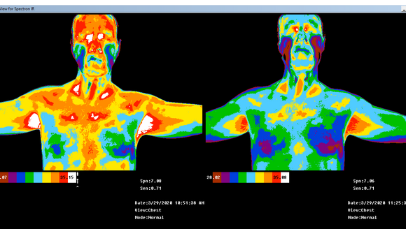 Thermal Body Imaging by https://safebodyimaging.com in Henderson, NV ...