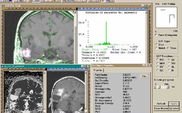 Image Recognition Software by 1 World Solutions