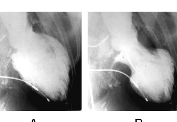 Video on How Trauma Impacts our Hearts by TherapyUtah - Center for Hope and Healing