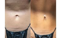 Airbrush Contouring by Body Bronzing Savannah