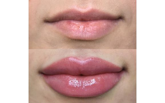 Lip Blush Tattoo $400 by Angela Carley - VSL in Abbotsford, BC - Alignable