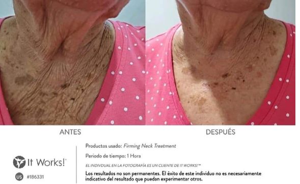 it works neck firming cream