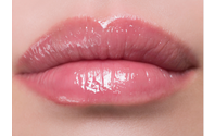 Juvederm by Results Medical Spa