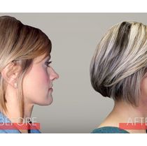 Full Face/Epigenetic Orthodontics by Ozark Comprehensive Dentistry