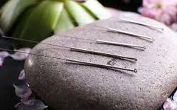 Acupuncture by Moon Brook Medicine