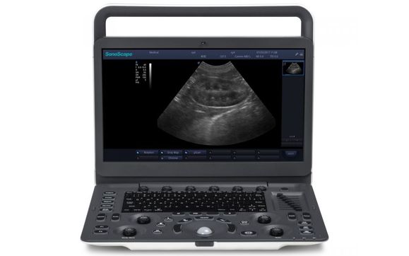 Diagnostic Ultrasound by VEQ