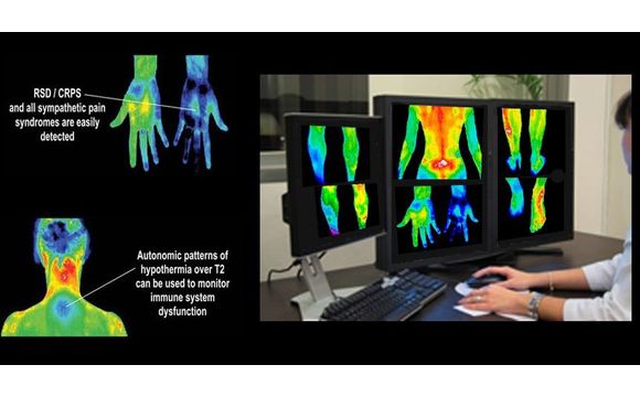 Thermography by Docs Outside The Box