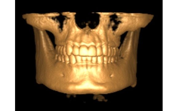 Honolulu dentist by Pacific Dental & Implant Solutions