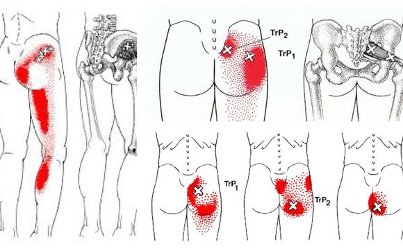 Cincinnati BodyWork Solutions, Precision Neuromuscular Therapy