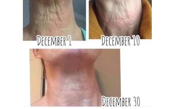 LimeLife Dew Confidence   by Women Empowering Women -- Limelife- Professional level skincare and makeup