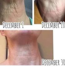 LimeLife Dew Confidence   by Women Empowering Women -- Limelife- Professional level skincare and makeup