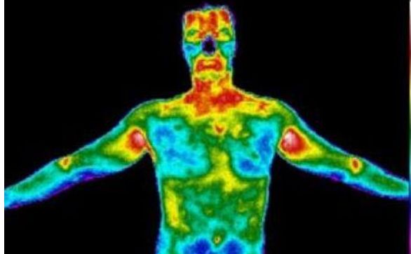 Medical Thermography by Hayden Health & Wellness