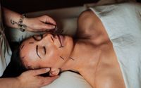 Cosmetic Facial Acupuncture  by Poyntz Acupuncture