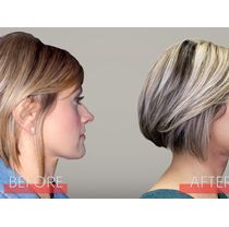 Orthodontist Services by Ozark Comprehensive Dentistry