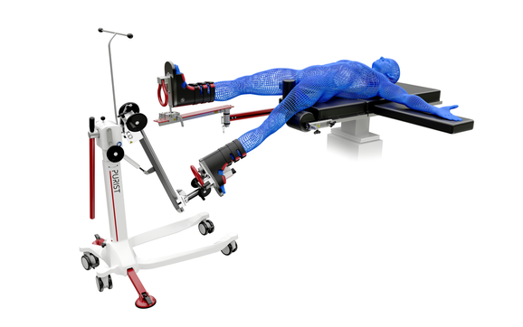 PURIST Leg Positioning System by Innovative Orthopedic Technologies in ...