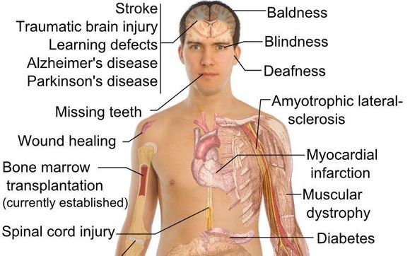 Stem cell nutrition can give you incredible health benefits! by Tracey Cade