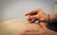 Acupuncture by Queen City Health and Wellness (Toni Haugen L.Ac)