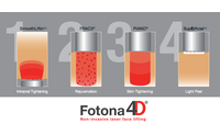 Fotona 4D Laser Face-Lift by Ashtoria Aesthetics & Wellness