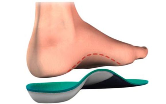 Custom Foot Orthotics by The Foot, Ankle & Vein Specialists in Venice ...