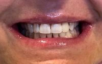 Family Dentistry by Johnny Gerald Foster
