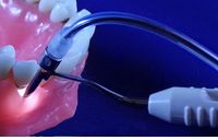 Non-Invasive Alternative to Gingival Flap Surgery by Oravu