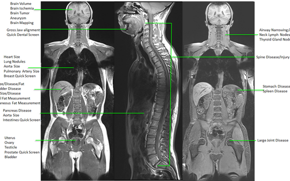 Whole Body MRI Wellness Screening by Ugorji Radiology Consultants in