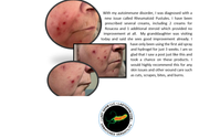 Wounds that Never Heal?   by LastGerm.com