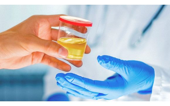 Drug Testing by ARCpoint Labs of Minneapolis