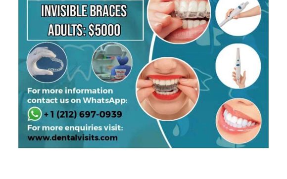 Clear aligners by Gilmore Loretta DDS