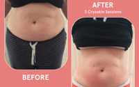 Online Appointment Booking by Body Thief Body Sculpting