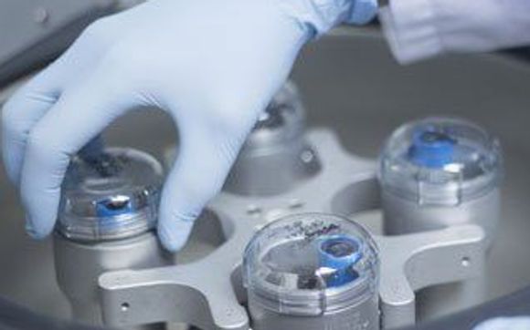 PRP - Platelet Rich Plasma / Vampire Lift by LMC - Laser Medical Clinic