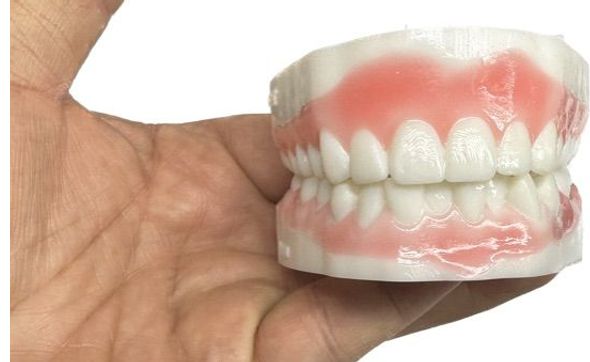 Smile by Design  printed 6 thru 11 Digital Waxup by Smile By Design Dental Studio