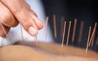 Acupuncture by Holistic Harmony LLC