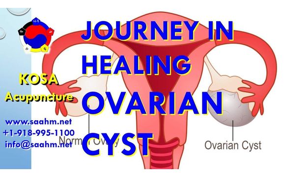 Ovarian Cyst Healing Journey With Kosa Acupuncture By Kosa Acupuncture In Jenks Ok Alignable