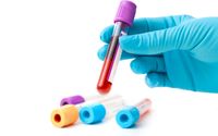 B2B Mobile Phlebotomy for your Healthcare Service by Atria Mobile Blood Draw ❥ Housecall Phlebotomy