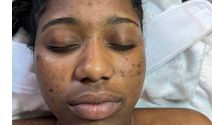 Medical aesthetics facial work and permanent make up by Prestigious Butterflies