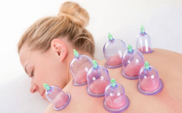 Cupping, Scraping, and IASTM by LifeForce Wellspring in San Marcos, CA ...